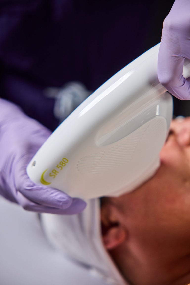 Photorejuvenation
